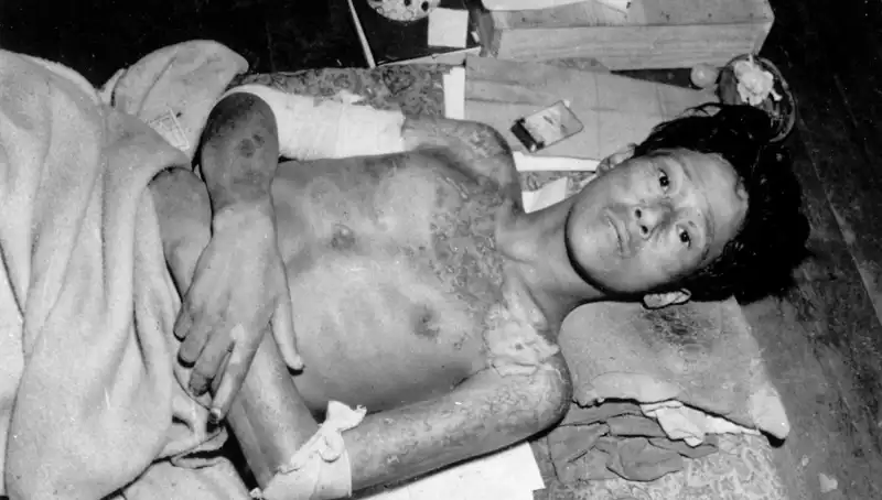 80 Yıl Sonra Nagasaki’den Gelen Felaket Uyarısı: Nükleer Tehdit Artıyor