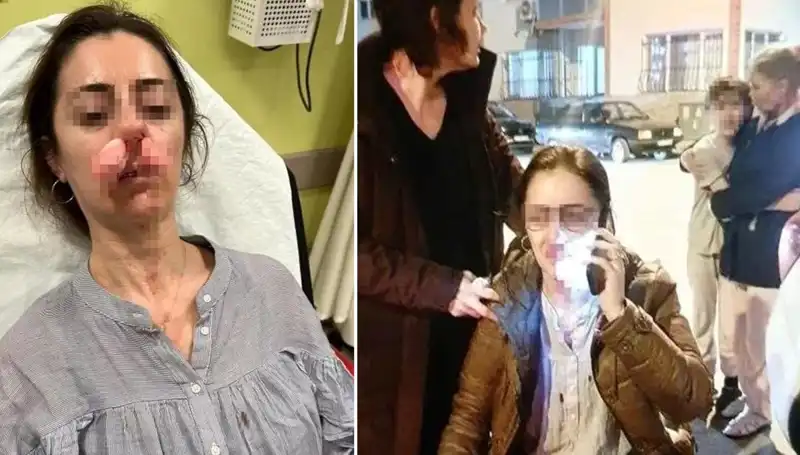 Eşinin Sevgilisi Sandığı Kapıya Saldırdı: Olayın Detayları Şaşırtıyor!